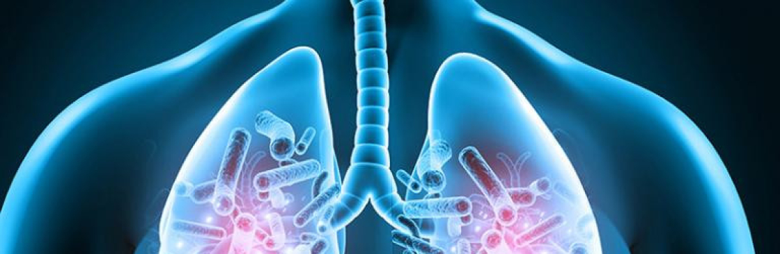 Chest Clinic Varanasi Cover Image