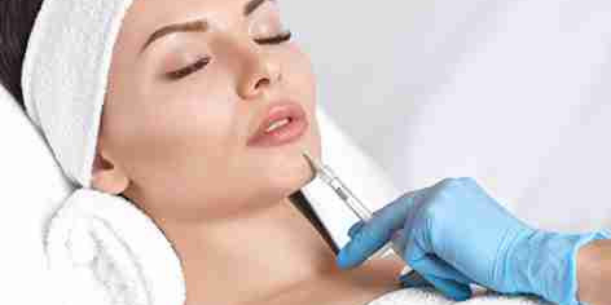 Lip Filler Trends: Modern Looks for Every Face Shape