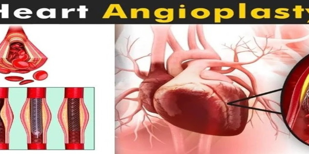 Best TAVI-TAVR Treatment Doctor and Expert in Jaipur, Rajasthan – Dr. Ravinder Singh Rao