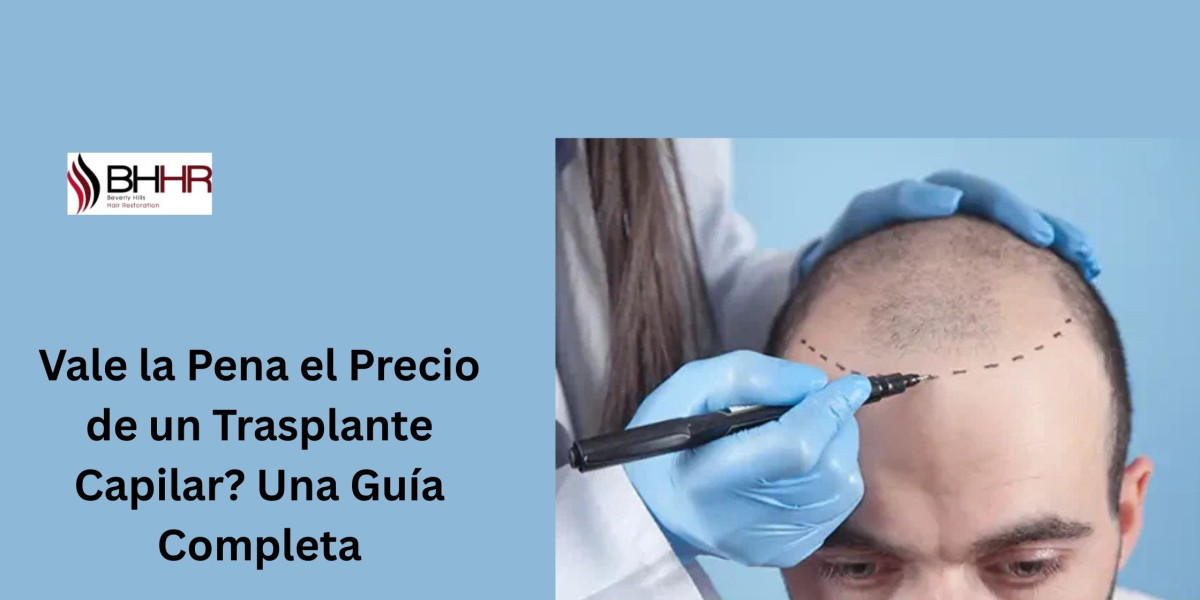 Vale la Pena el Precio de un Trasplante Capilar? Una Guía Completa