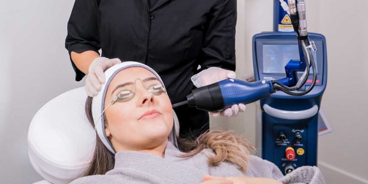 تجربة علاج الكلف بالليزر الجزئي خطوة بخطوة