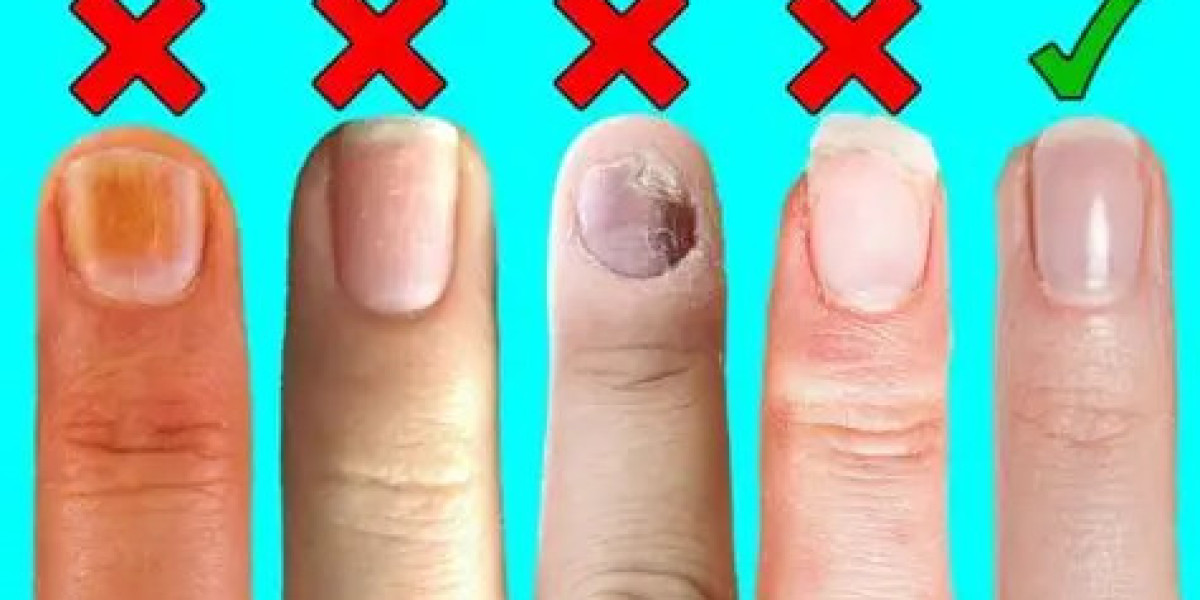 Support Strong and Healthy Nails Naturally with Complete Care Formula