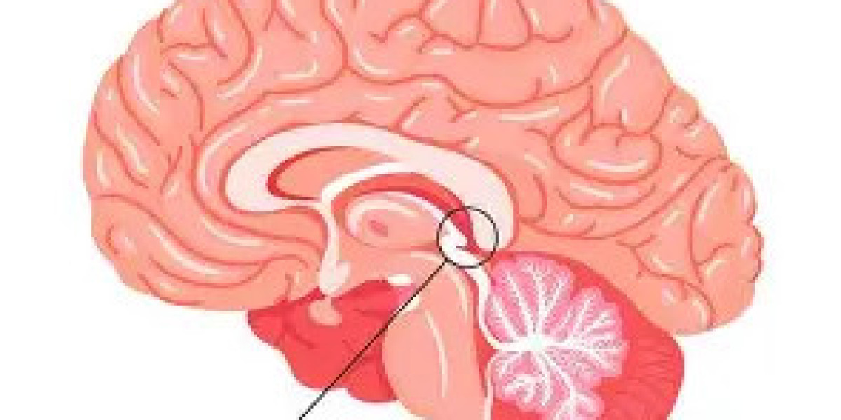 Support Pineal Gland for Mental Clarity, Better Sleep, and Inner Balance