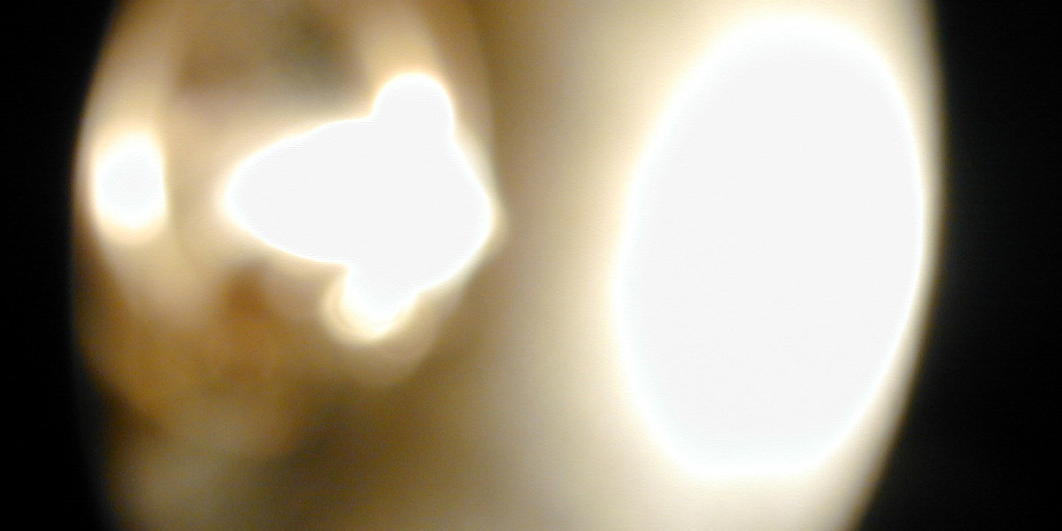 Doping: Wachstumshormone