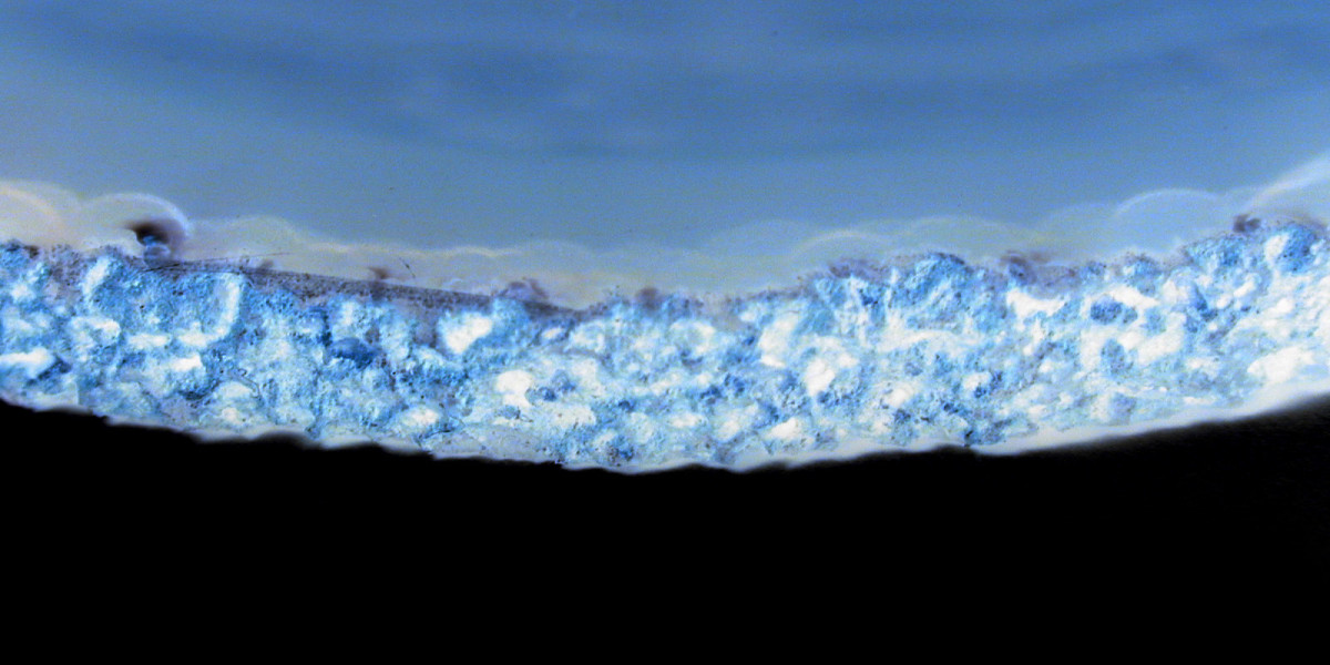 HGH – Wirkung und Anwendungsgebiete des Wachstumshormons