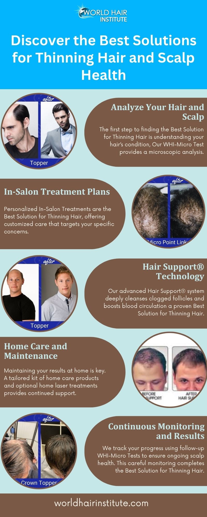 Discover the Best Solutions for Thinning Hair and Scalp Health — Freeimage.host