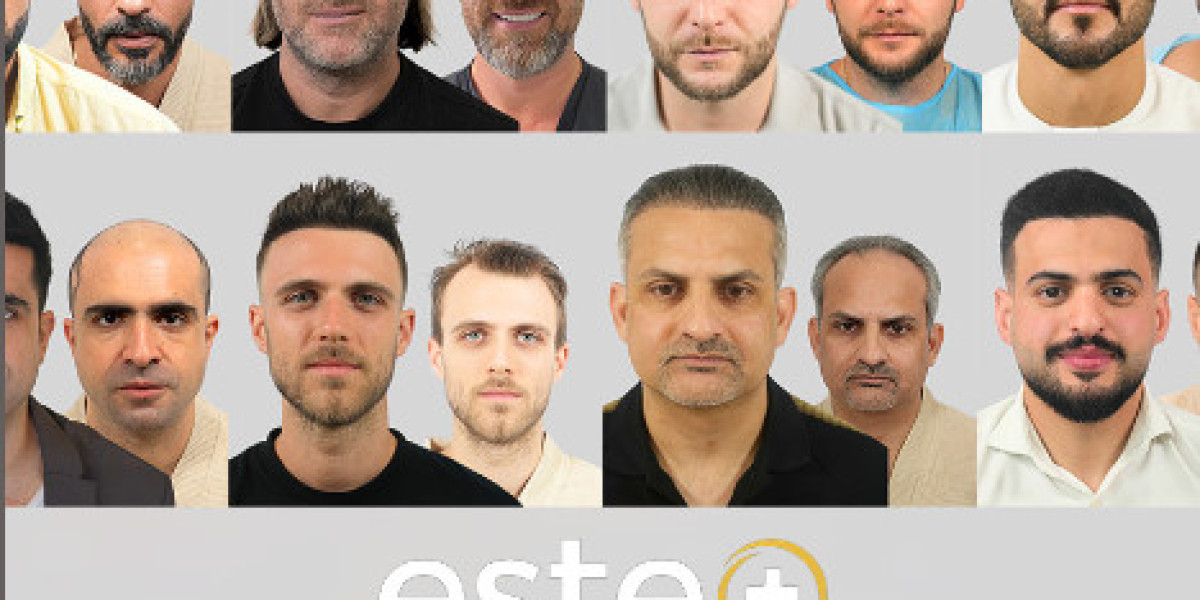 What should I ask a Dubai clinic before booking a hair transplant in 2025?