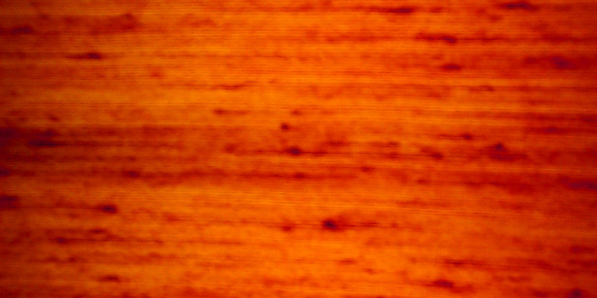 Anavar 2019 Guide Cycle, Dosage, Side Effects And Outcomes