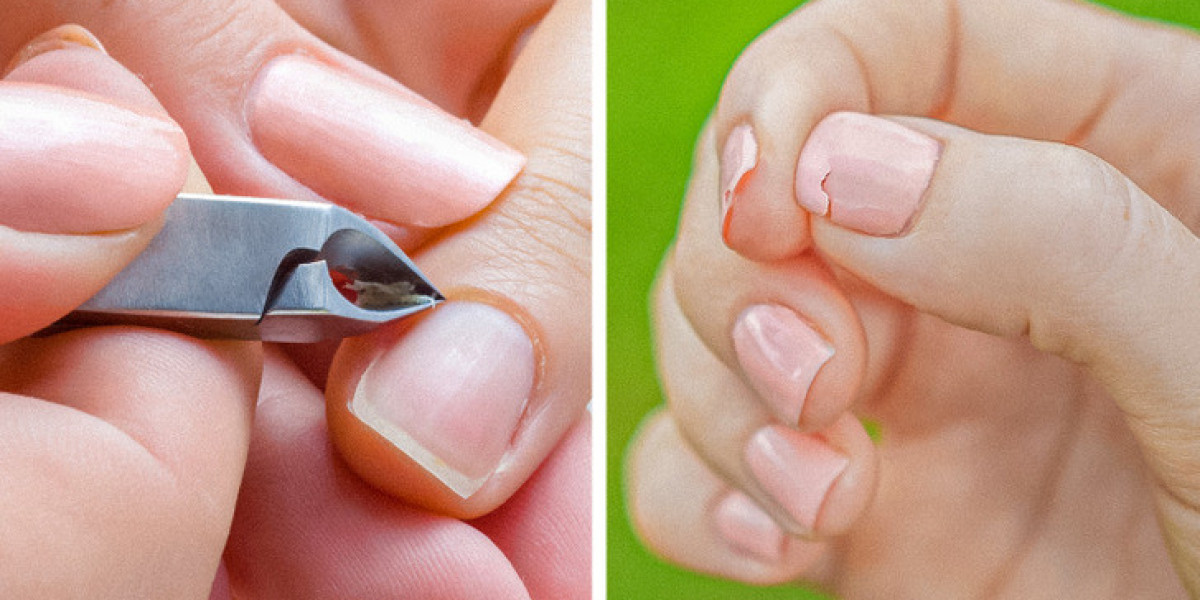 Strong Nails and Skin – Natural Support for Lasting Beauty and Health