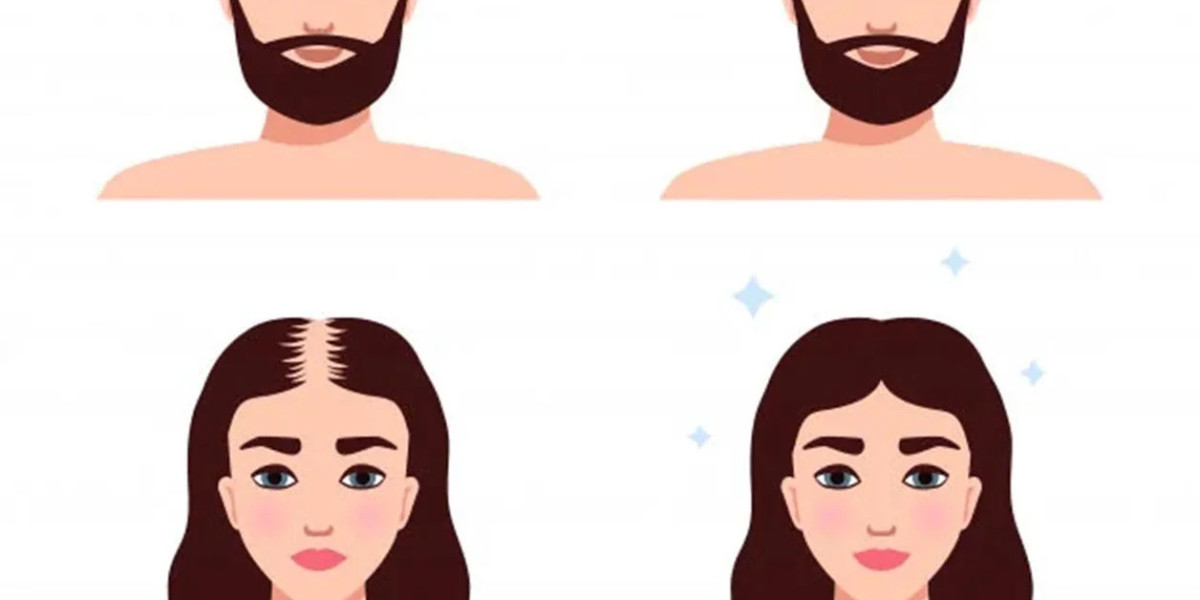 hair replacement system